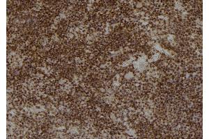 ABIN6276876 at 1/100 staining Mouse spleen tissue by IHC-P. (AKR1C3 antibody)