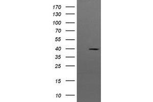 Image no. 2 for anti-Mitogen-Activated Protein Kinase Kinase 3 (MAP2K3) antibody (ABIN1499420) (MAP2K3 antibody)