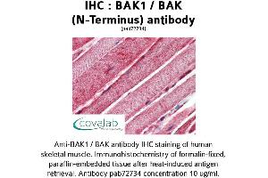 Image no. 2 for anti-BCL2-Antagonist/killer 1 (BAK1) (N-Term) antibody (ABIN1732215) (BAK1 antibody  (N-Term))