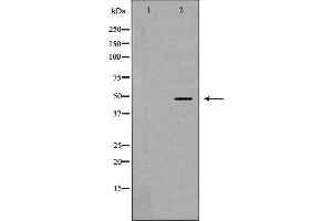 Western blot analysis of MCF7 cell lysate, using TACR1 Antibody.