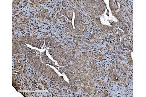 IHC analysis of REA/PHB2 using anti-REA/PHB2 antibody (ABIN7599239).