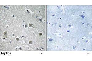 Immunohistochemistry analysis of paraffin-embedded human brain tissue using MYLIP polyclonal antibody .