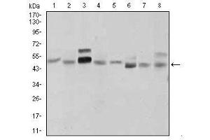 Image no. 4 for anti-Sonic Hedgehog (SHH) antibody (ABIN1491290) (Sonic Hedgehog antibody)