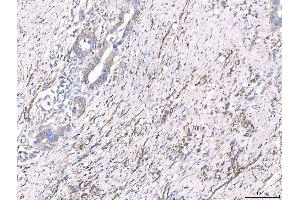 IHC analysis of CD93 using anti-CD93 antibody (ABIN7602865). (CD93 antibody  (C-Term))