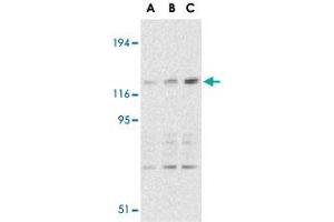 Western blot analysis of CARD11 expression in mouse thymus tissue lysate with CARD11 polyclonal antibody  at 0. (CARD11 antibody  (C-Term))