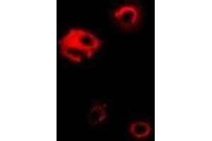 Immunofluorescent analysis of PGK1 staining in Hela cells. (PGK1 antibody)