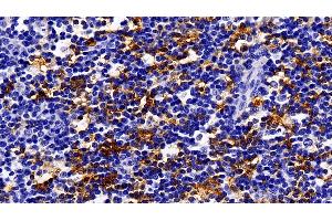 Immunohistochemistry (IHC) image for anti-Fas (TNFRSF6)-Associated Via Death Domain (FADD) (AA 12-206) antibody (ABIN7439960)