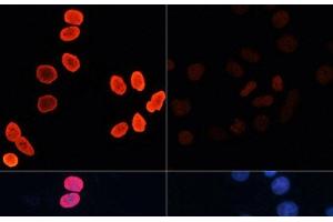 Immunofluorescence (IF) image for anti-Histone H2B (acLys15) antibody (ABIN7258526)