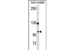 DLGAP3 anticorps  (N-Term)