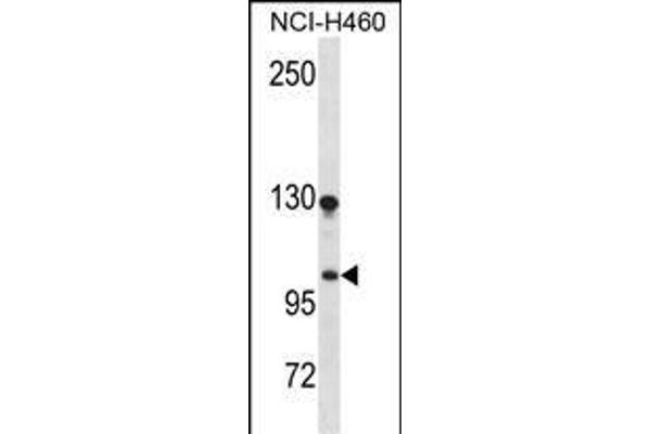 DLGAP3 anticorps  (N-Term)