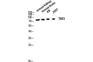 Western Blot (WB) analysis of Mouse Kidney Mouse Brain KB 293T lysis using TBX3 antibody. (TBX3 antibody  (Internal Region))