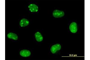 Immunofluorescence of purified MaxPab antibody to EMG1 on HeLa cell.