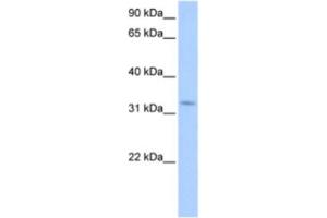 Western Blotting (WB) image for anti-Nuclear Receptor Interacting Protein 2 (NRIP2) antibody (ABIN2463362)