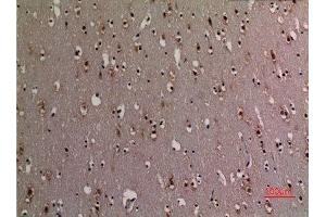 Immunohistochemistry (IHC) image for anti-X-Ray Repair Complementing Defective Repair in Chinese Hamster Cells 6 (XRCC6) (acLys542) antibody (ABIN3181890)