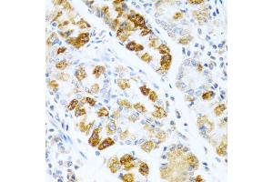 Immunohistochemistry of paraffin-embedded human stomach using BMP3 antibody (ABIN5975705) at dilution of 1/100 (40x lens). (BMP3 antibody)