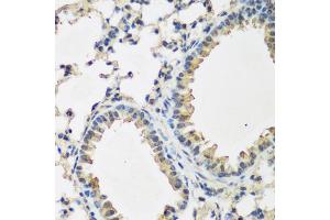 Immunohistochemistry of paraffin-embedded mouse lung using BMP2 antibody. (BMP2 antibody)