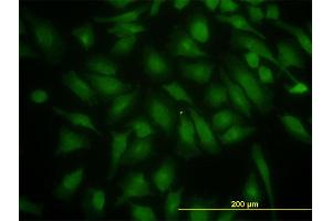 Immunofluorescence of monoclonal antibody to PIK3R4 on HeLa cell. (PIK3R4 antibody  (AA 1259-1358))