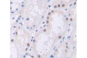 Figure. (Polybromo 1 antibody  (AA 1152-1273))