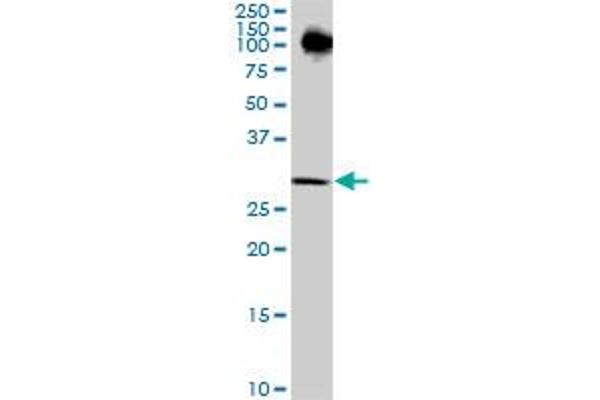 RPRD1A antibody  (AA 76-170)