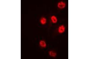 Immunofluorescent analysis of Histone Deacetylase 1 staining in HeLa cells. (HDAC1 antibody  (C-Term))