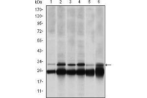 Western blot analysis using PSMB8 mouse mAb against Hela (1), MCF-7 (2), A431 (3), RAJI (4), MOTL4 (5) and PC-12 (6) cell lysate.