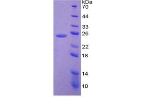 SDS-PAGE of Protein Standard from the Kit  (Highly purified E. (IL-6 ELISA Kit)