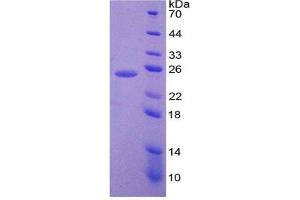 SDS-PAGE of Protein Standard from the Kit  (Highly purified E. (IL-6 ELISA Kit)