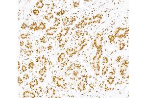 Immunohistochemistry (IHC) image for anti-Sp1 Transcription Factor (SP1) (AA 250-300) antibody (ABIN7795787)