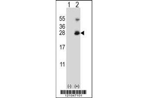 Western blot analysis of RNF11 using rabbit polyclonal RNF11 Antibody using 293 cell lysates (2 ug/lane) either nontransfected (Lane 1) or transiently transfected (Lane 2) with the RNF11 gene. (RNF11 antibody  (AA 64-90))