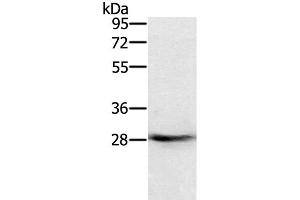 Western Blot analysis of Human normal colon tissue using RAB8B Polyclonal Antibody at dilution of 1:400 (RAB8B antibody)