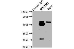 Immunoprecipitating SQSTM1 in Hela whole cell lysate Lane 1: Rabbit control IgG (1 μg) instead of ABIN7168871 in Hela whole cell lysate. (SQSTM1 antibody  (AA 16-310))