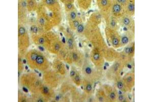 Used in DAB staining on fromalin fixed paraffin-embedded Liver tissue (CAMKII gamma antibody  (AA 75-281))