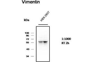 Western Blot (WB) analysis of 293T cell with Mouse Monoclonal Antibody diluted at 1:1000. (Vimentin antibody)