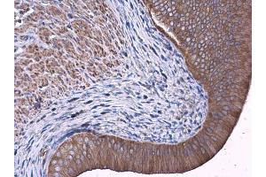 IHC-P Image FAK antibody detects FAK protein at cytoplasm in rat cervix by immunohistochemical analysis. (FAK antibody  (C-Term))