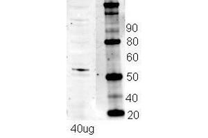 Western Blotting (WB) image for anti-Nuclear Respiratory Factor 1 (NRF1) (N-Term) antibody (ABIN2780635)