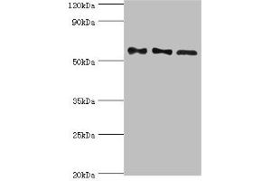 Western blot All lanes: Serine/threonine-protein phosphatase 2B catalytic subunit gamma isoform antibody at 10 μg/mL Lane 1: Rat brain tissue Lane 2: MCF-7 whole cell lysate Lane 3: Rat skeletal muscle tissue Secondary Goat polyclonal to rabbit IgG at 1/10000 dilution Predicted band size: 59, 58, 60 kDa Observed band size: 59 kDa (PPP3CC antibody  (Catalytic Subunit gamma))