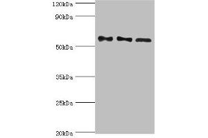 PPP3CC antibody  (Catalytic Subunit gamma)