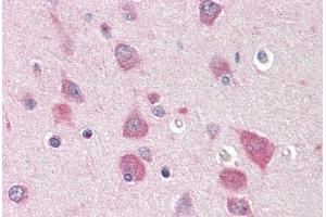 Human Brain, Cortex (formalin-fixed, paraffin-embedded) stained with MYO5B antibody ABIN396915 at 20 ug/ml followed by biotinylated goat anti-rabbit IgG secondary antibody ABIN481713, alkaline phosphatase-streptavidin and chromogen. (MYO5B antibody  (C-Term))