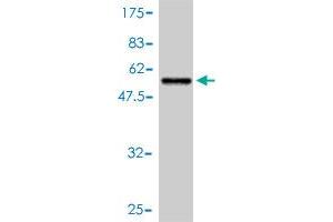 Western Blot detection against Immunogen (53. (14-3-3 sigma/SFN antibody  (AA 1-248))