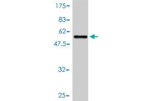 Western Blot detection against Immunogen (53. (14-3-3 sigma/SFN antibody  (AA 1-248))