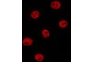 ABIN6277090 staining Hela by IF/ICC. (POLR2A/RPB1 antibody  (Internal Region))