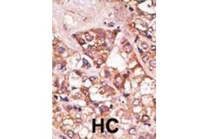Immunohistochemistry (IHC) image for anti-BCL2-Interacting Killer (Apoptosis-Inducing) (BIK) (BH3 Domain) antibody (ABIN2997206) (BIK antibody  (BH3 Domain))