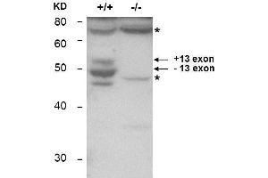 Western Blotting (WB) image for anti-Bridging Integrator 1 (BIN1) antibody (ABIN1043740)