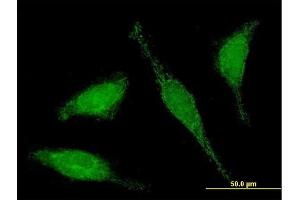 Immunofluorescence of purified MaxPab antibody to C6orf206 on HeLa cell. (RSPH9 antibody  (AA 1-276))