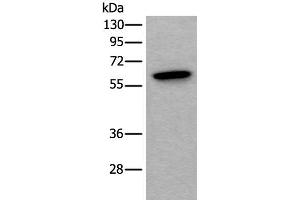Western blot analysis of Mouse testis tissue lysate using SCP2 Polyclonal Antibody at dilution of 1:350 (SCP2 antibody)