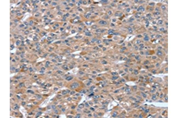 RASAL1 antibody