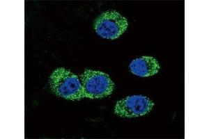 Confocal immunofluorescent analysis of RAGE antibody with MDA-MB231 cells followed by Alexa Fluor 488-conjugated goat anti-rabbit lgG (green). (RAGE antibody  (AA 206-234))