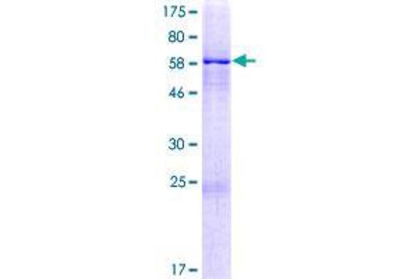 ZIK1 Protein (AA 1-384) (GST tag)