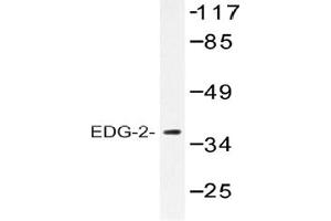 Image no. 1 for anti-Lysophosphatidic Acid Receptor 1 (LPAR1) antibody (ABIN317688) (LPAR1 antibody)