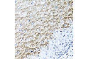 Immunohistochemistry of paraffin-embedded human esophagus using F3 antibody at dilution of 1:100 (x40 lens). (Tissue factor antibody)